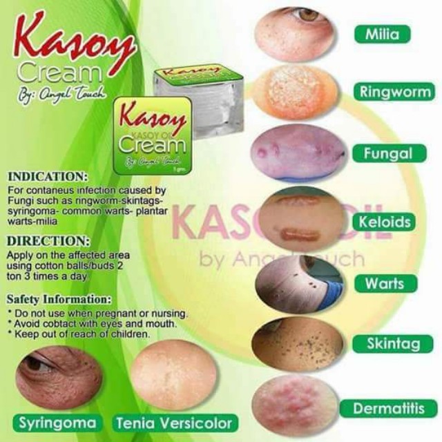 Kasoy cream, Beauty & Personal Care, Bath & Body, Body Care on Carousell