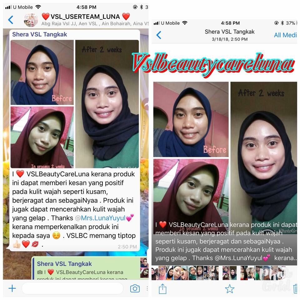 Vsl Beauty Care Health Beauty Skin Bath Body On Carousell