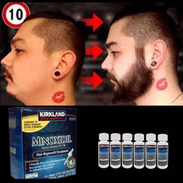 Featured image of post Kirkland Minoxidil Beard Before And After Minoxidil is most commonly known as rogaine and it has been around for a long time when it comes to stimulating hair for many years the beard has symbolized manhood and masculinity