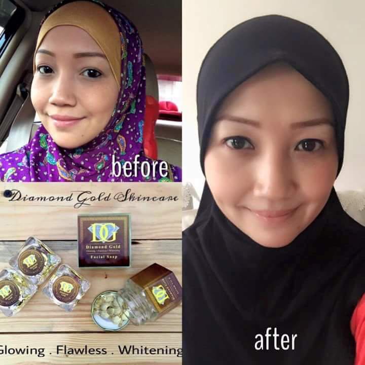 Diamond gold outlet skincare