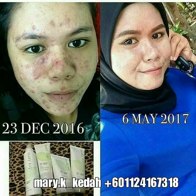 Botanical Effect Mary Kay Health Beauty Skin Bath Body On Carousell