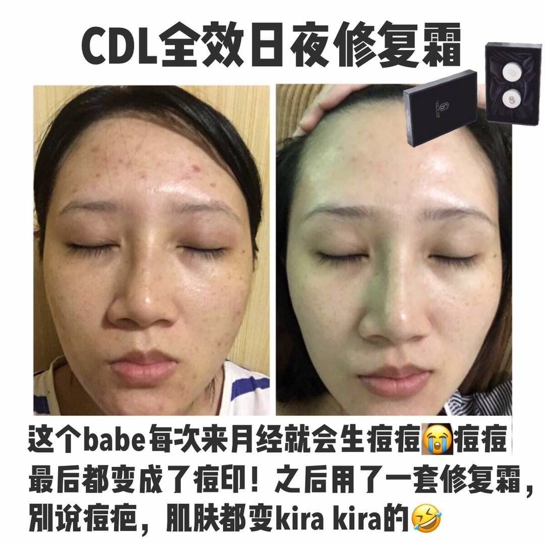 Cdl日夜修复霜 Health Beauty Bath Body On Carousell