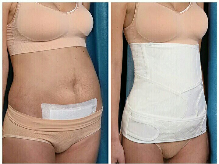 Abdominal Binder after c-sect, Babies & Kids, Maternity Care on