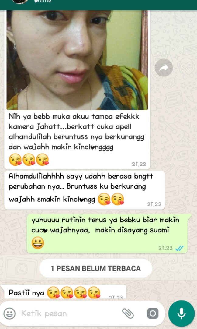 Cuka Apel Bragg Testimoniiii Kesehatan Kecantikan Kulit Sabun Tubuh Di Carousell