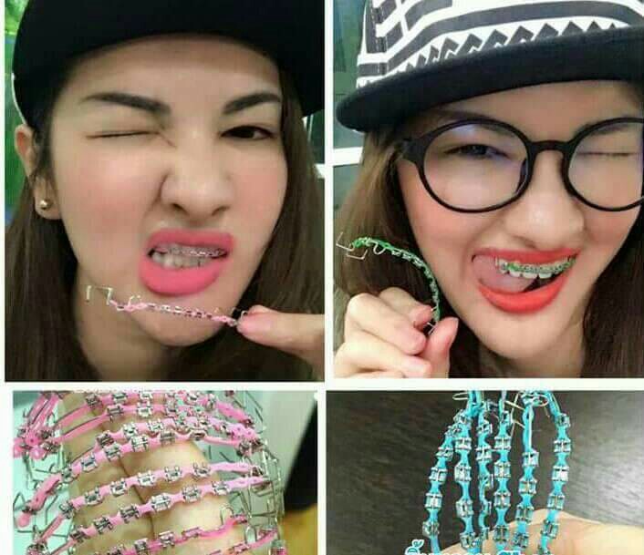 Wallpaper Fake Braces Click Everything Else Others On Carousell For Android