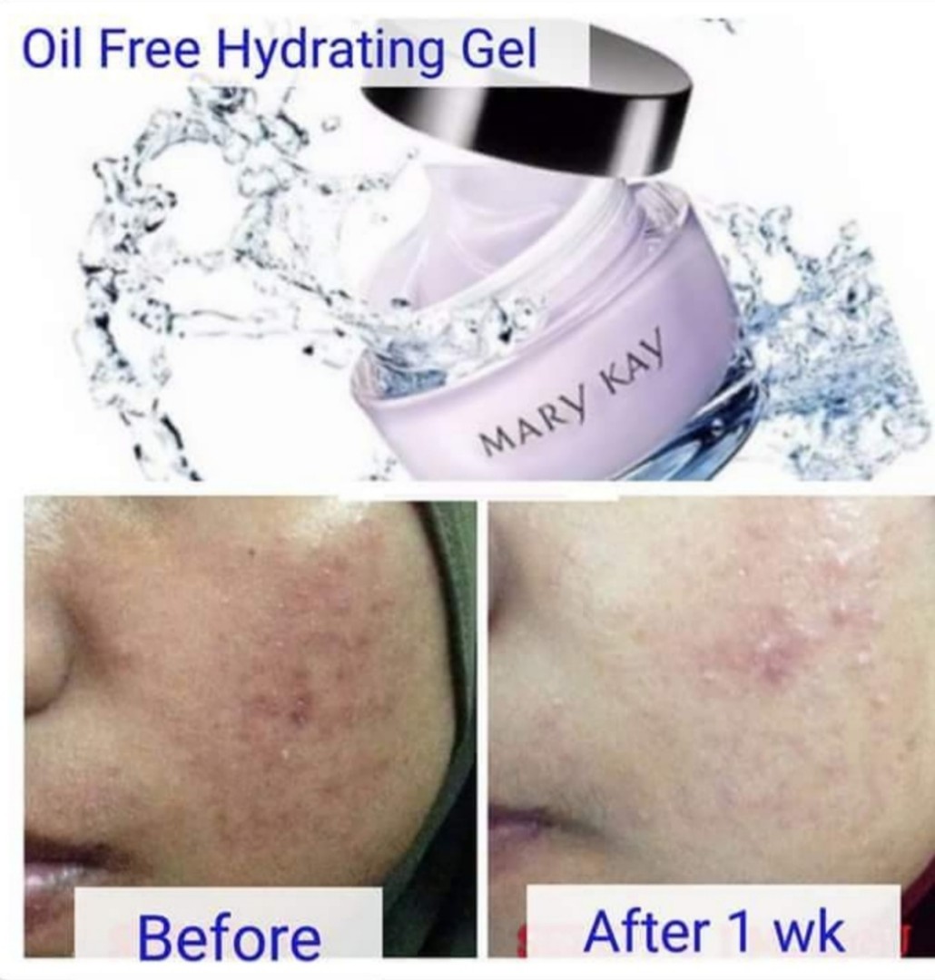 Marykay Oil Free Hydrating Gel Intensive Moisturizing Cream Or Sleeping Masks Health Beauty Bath Body On Carousell