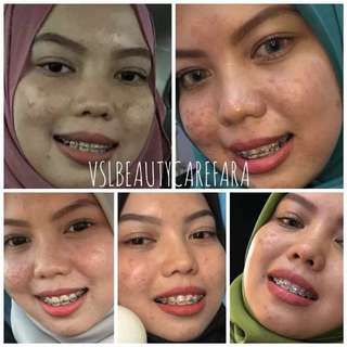 AINAA SERUM BY SYAFIQAH AINA, Produk Badan dan kecantikan 