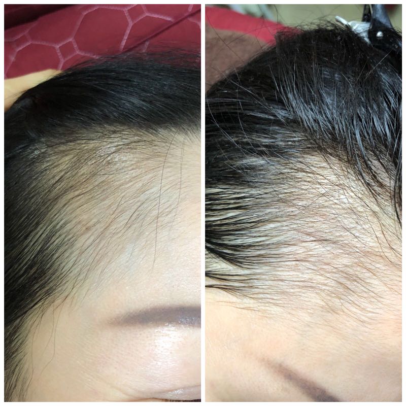 Hairline Tattoo Health Beauty Hair Care On Carousell