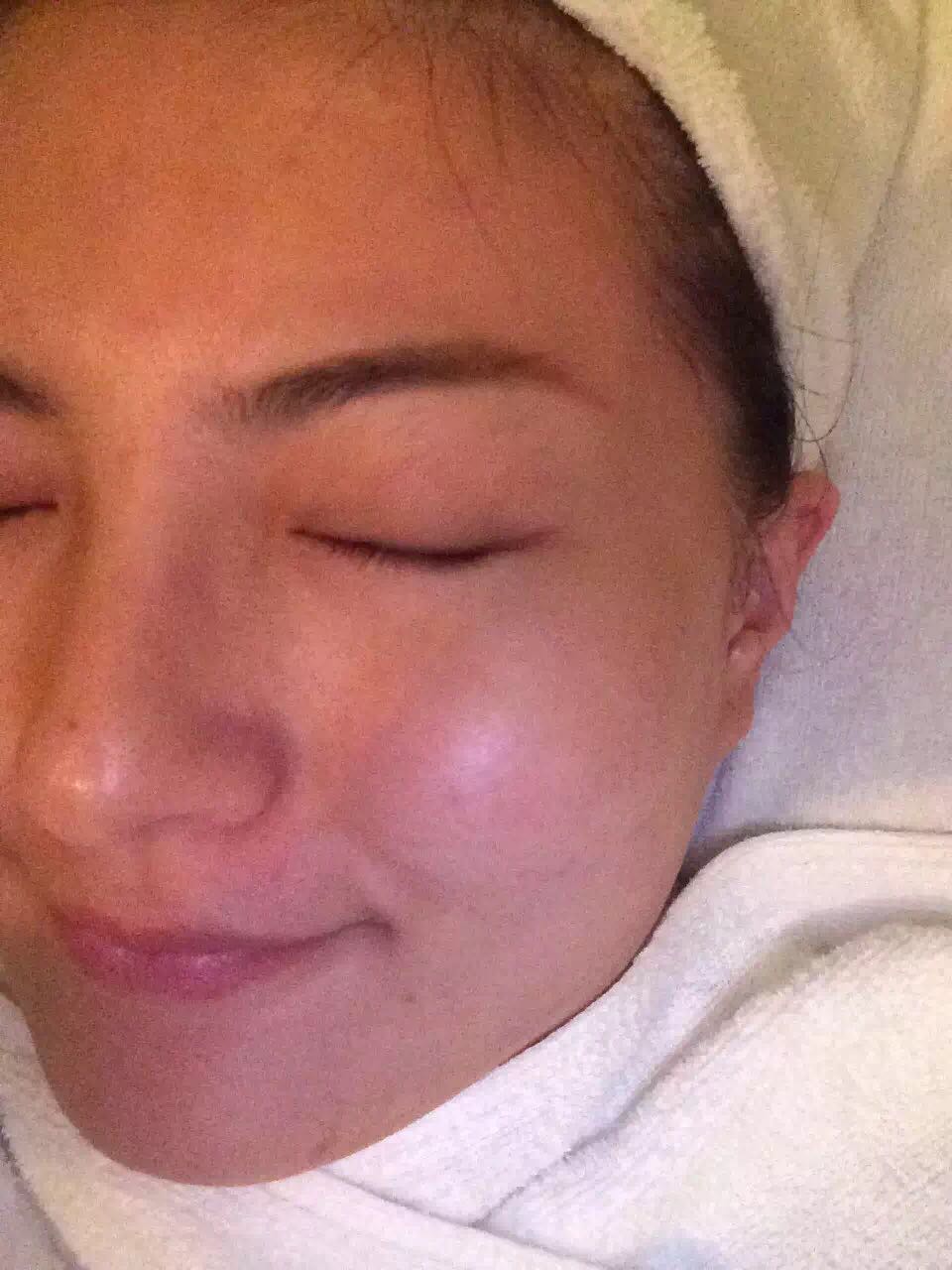 Can facial skin blemish think Facial skin blemish for
