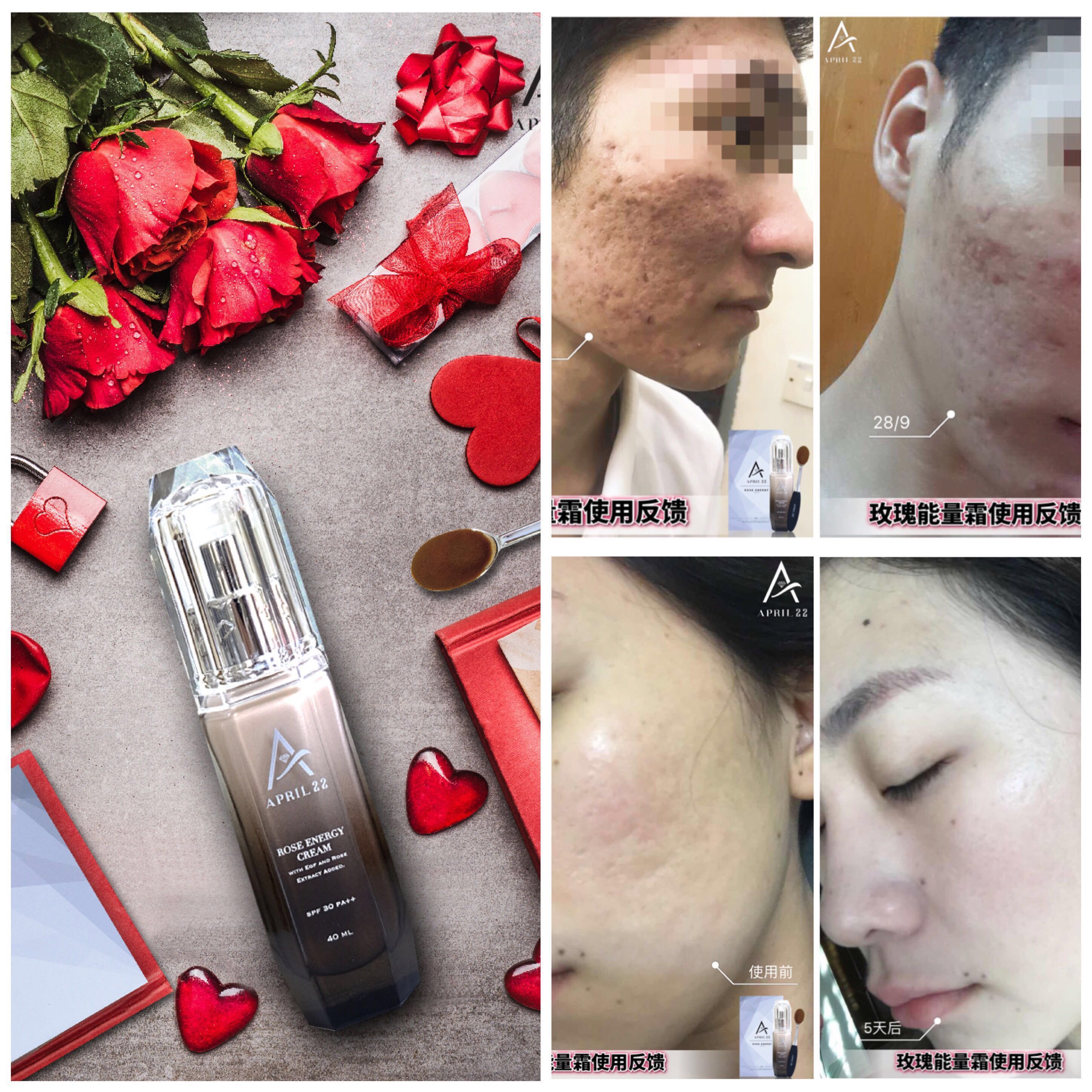April 22 Rose Energy Cream 5 In 1 Function Safe For Pregnant Nursing Mummies Too Health Beauty Face Skin Care On Carousell