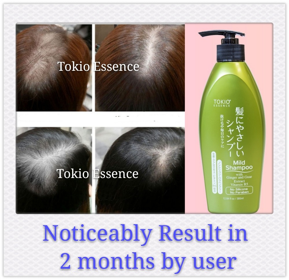 japanese hair loss shampoo