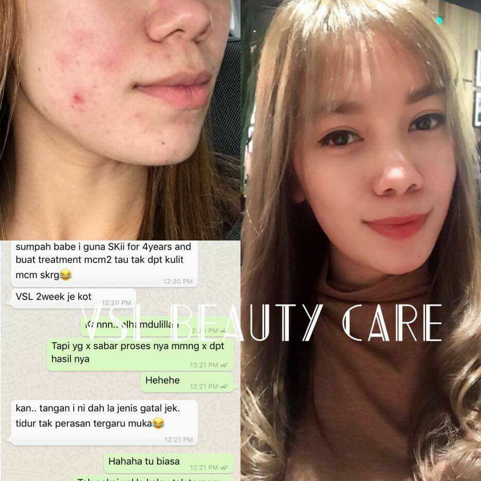 Vsl Health Beauty Face Skin Care On Carousell