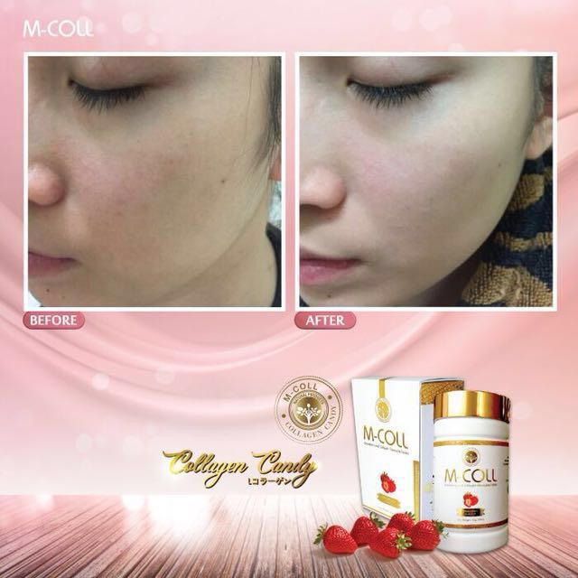 Collagen Candy (Japan), Health & Nutrition, Health Supplements, Health