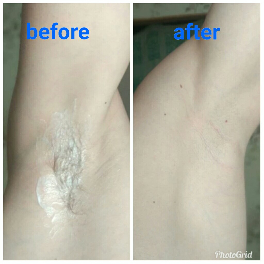 Water Ice Painless Depilatory Cream Legs Depilation Cream Hair