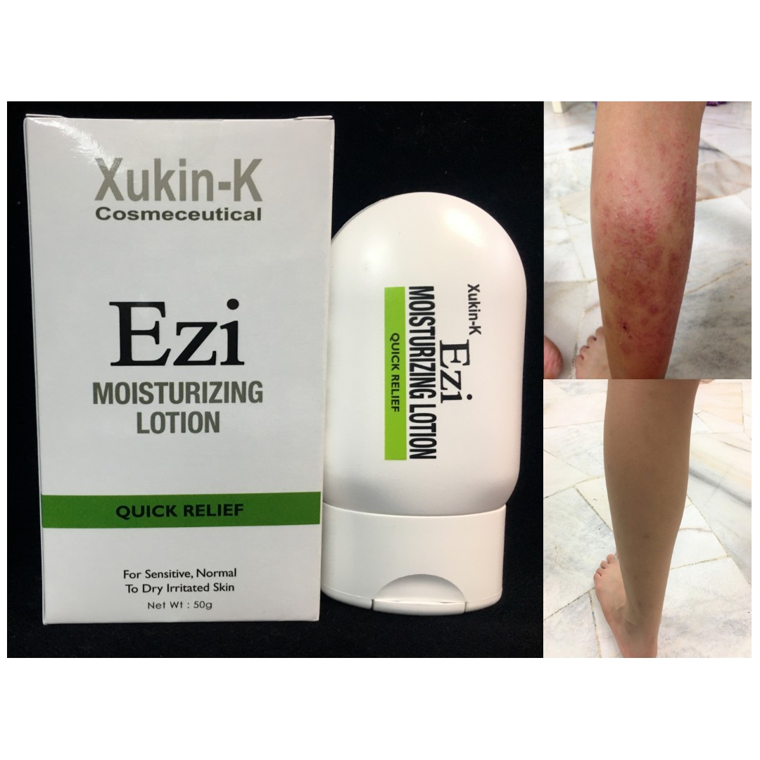 XukinK Ezi Moisturizing Lotion 50g For Eczema Non Steroid Atopic
