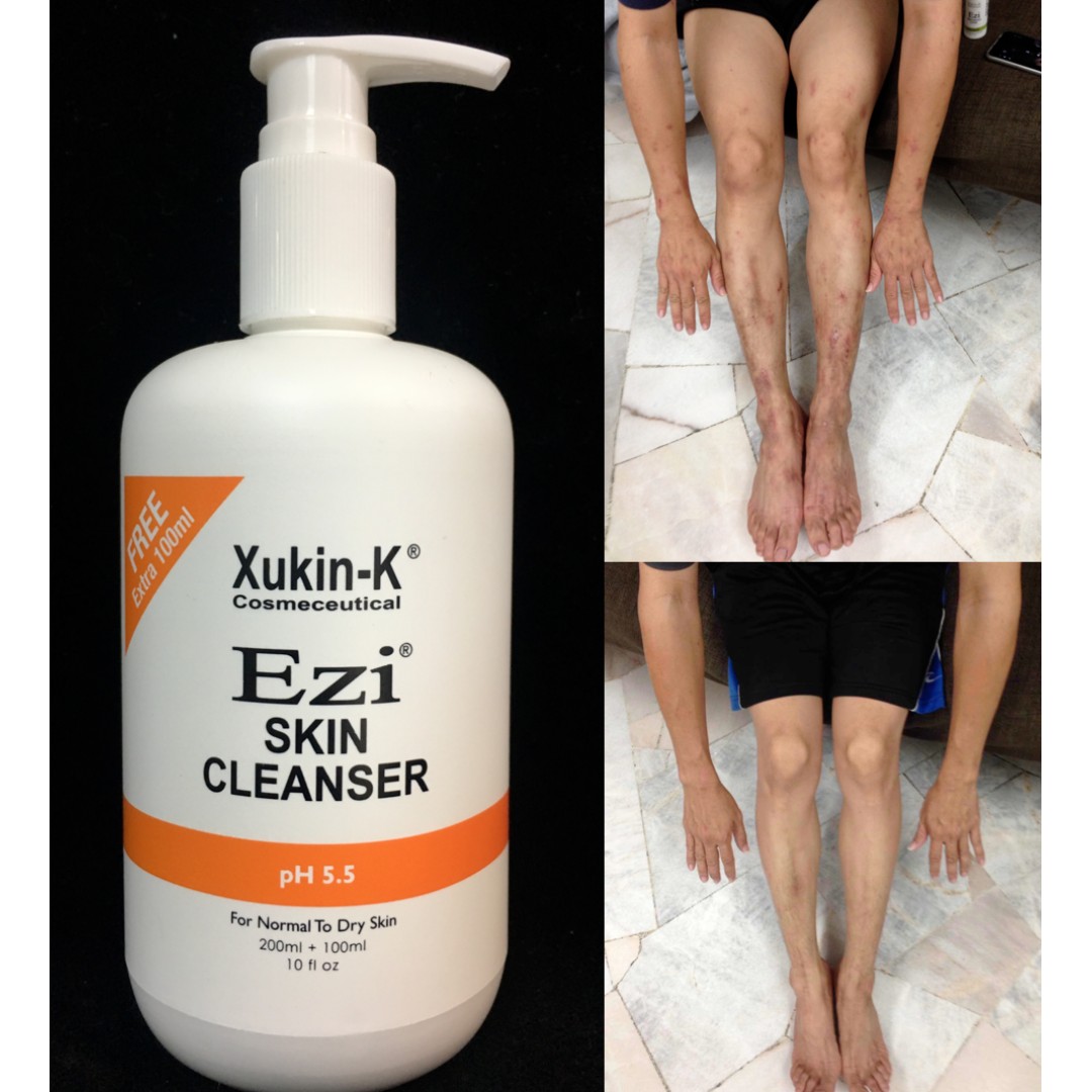 XukinK Ezi Skin Cleanser 300ml Shower Gel For Eczema Atopic Dermatitis