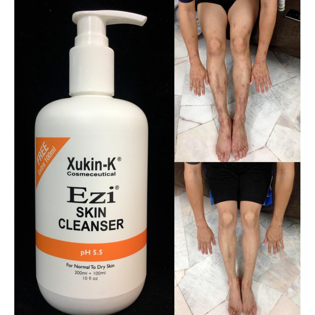 XukinK Ezi Skin Cleanser 300ml Shower Gel For Eczema Atopic Dermatitis