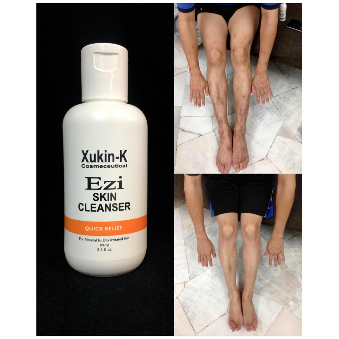 Shower gel top for eczema