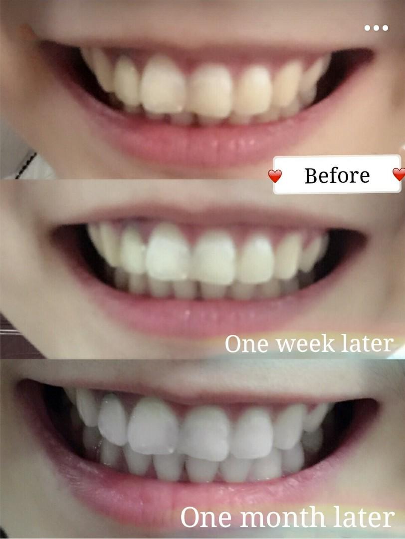 Crest 3d White Whitestrips Professional Effects美白牙贴 Health