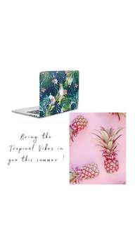Tropical Vibes - Macbook Hard Case
