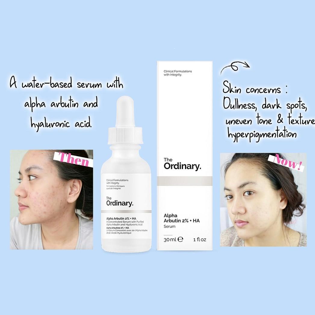 The Ordinary Alpha Arbutin 2 Ha Health Nutrition Health Supplements Vitamins Supplements On Carousell