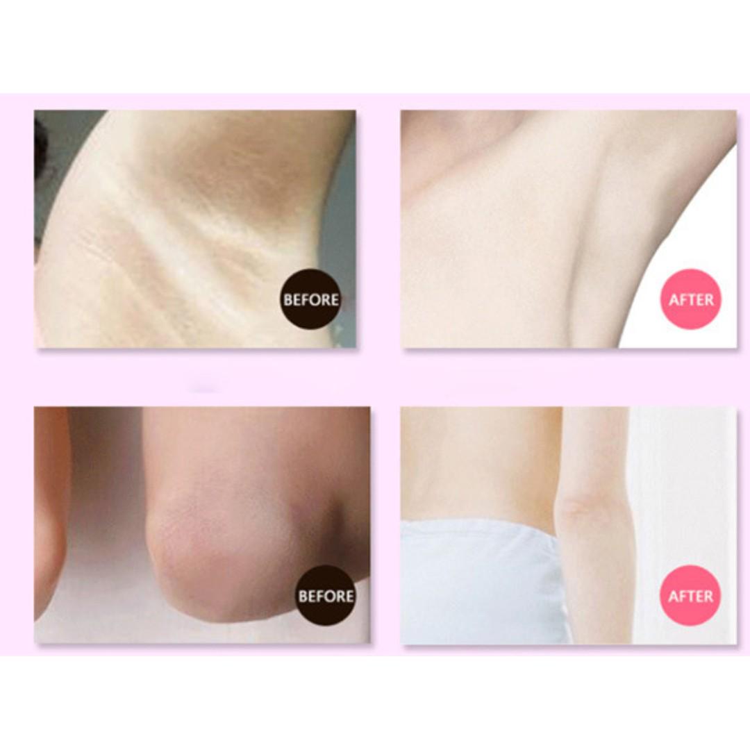 armpit bleaching