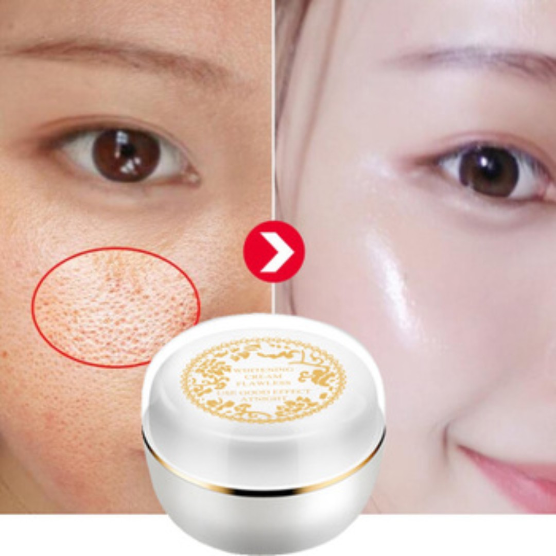 bioaqua freckle cream