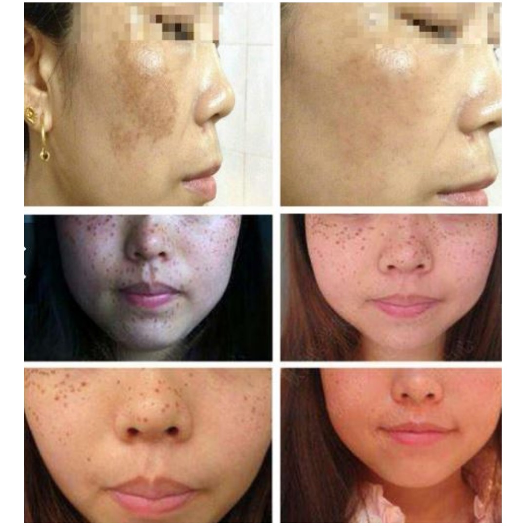 full body whitening
