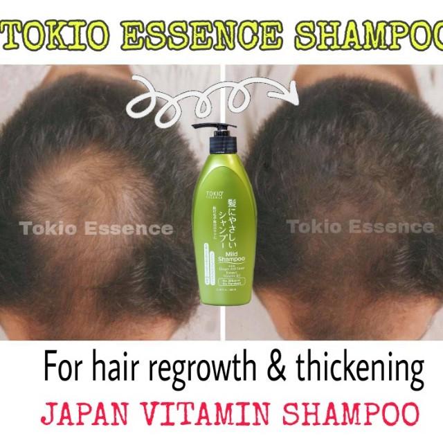 Hair Growth Japan Technology Health Beauty Hair Care On Carousell