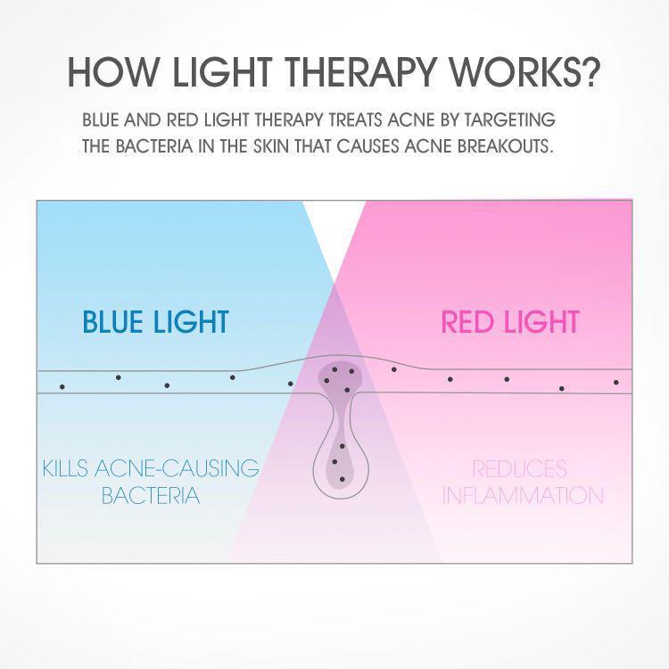 HANGSUN LIGHT THERAPY ACNE MASK FT330, Beauty & Personal Care, Face