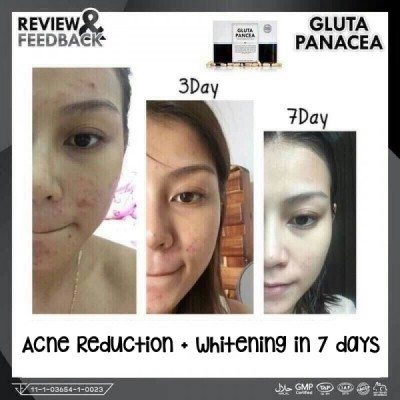 Wink White Gluta Pancea Authentic On Carousell