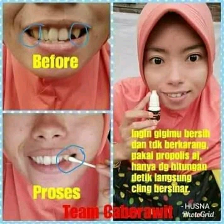 El Prima Propolis Olshop Fashion Olshop Produk Kecantikan Di Carousell