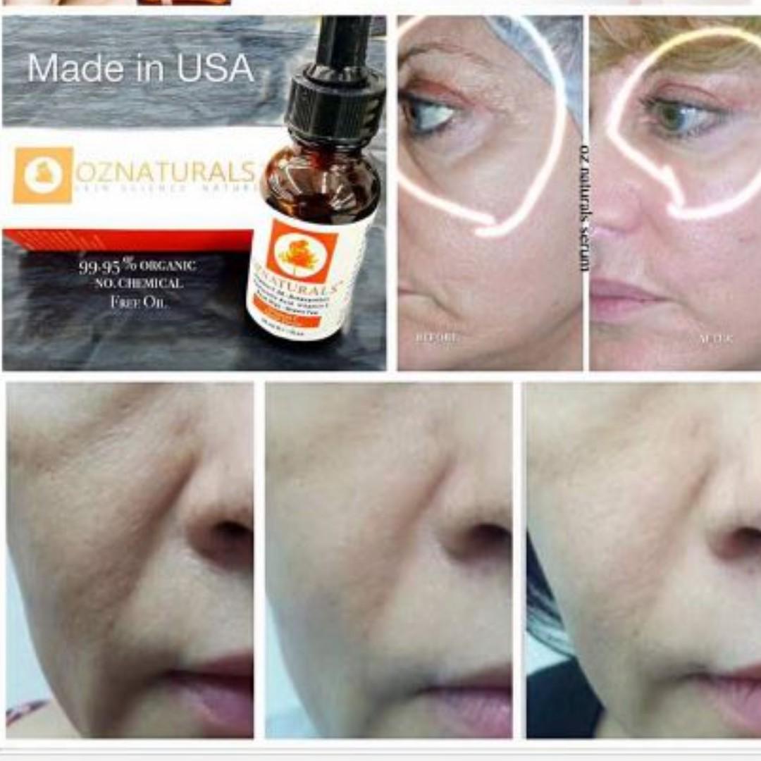 Authentic Oznaturals Vitamin C Vitamin E Hyaluronic Acid