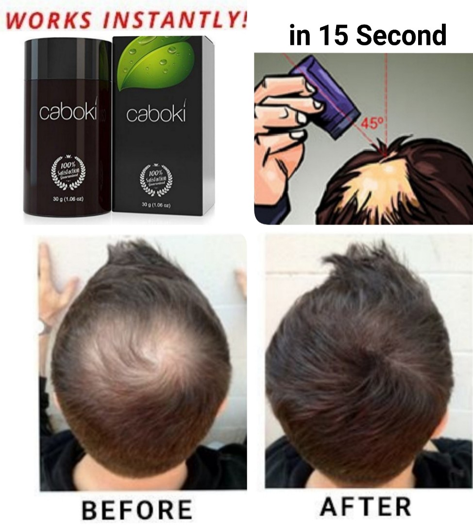 hair loss fiber for men and women
