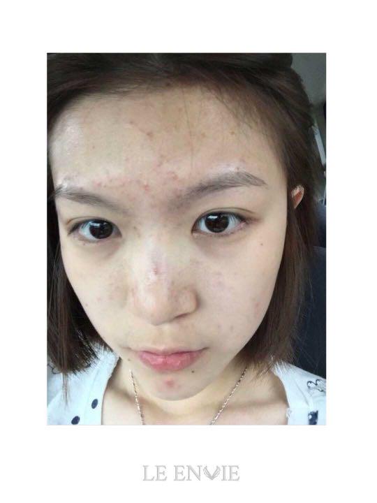 Clair De Lune Skin Care Health Beauty Skin Bath Body On Carousell