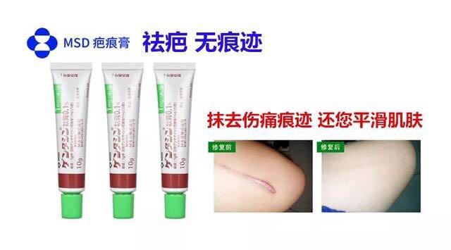 best scar treatment cream