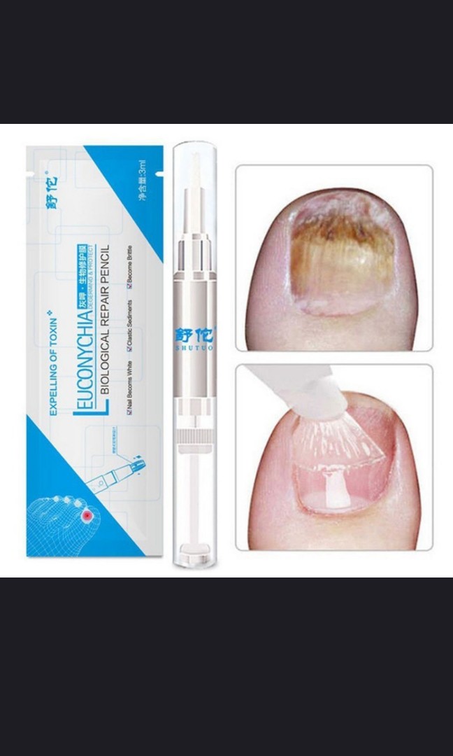 3ML ANTI FUNGAL TREATMENT NAIL PEN ONYCHOMYCOSIS PARONYCHIA INFECTION