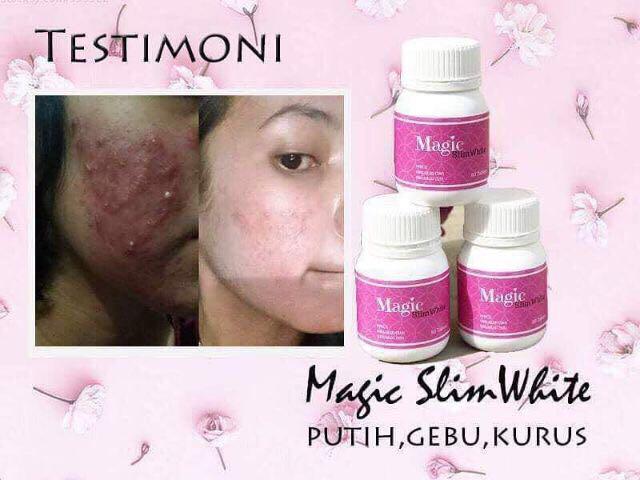 Magic Slim White Health Beauty Skin Bath Body On Carousell