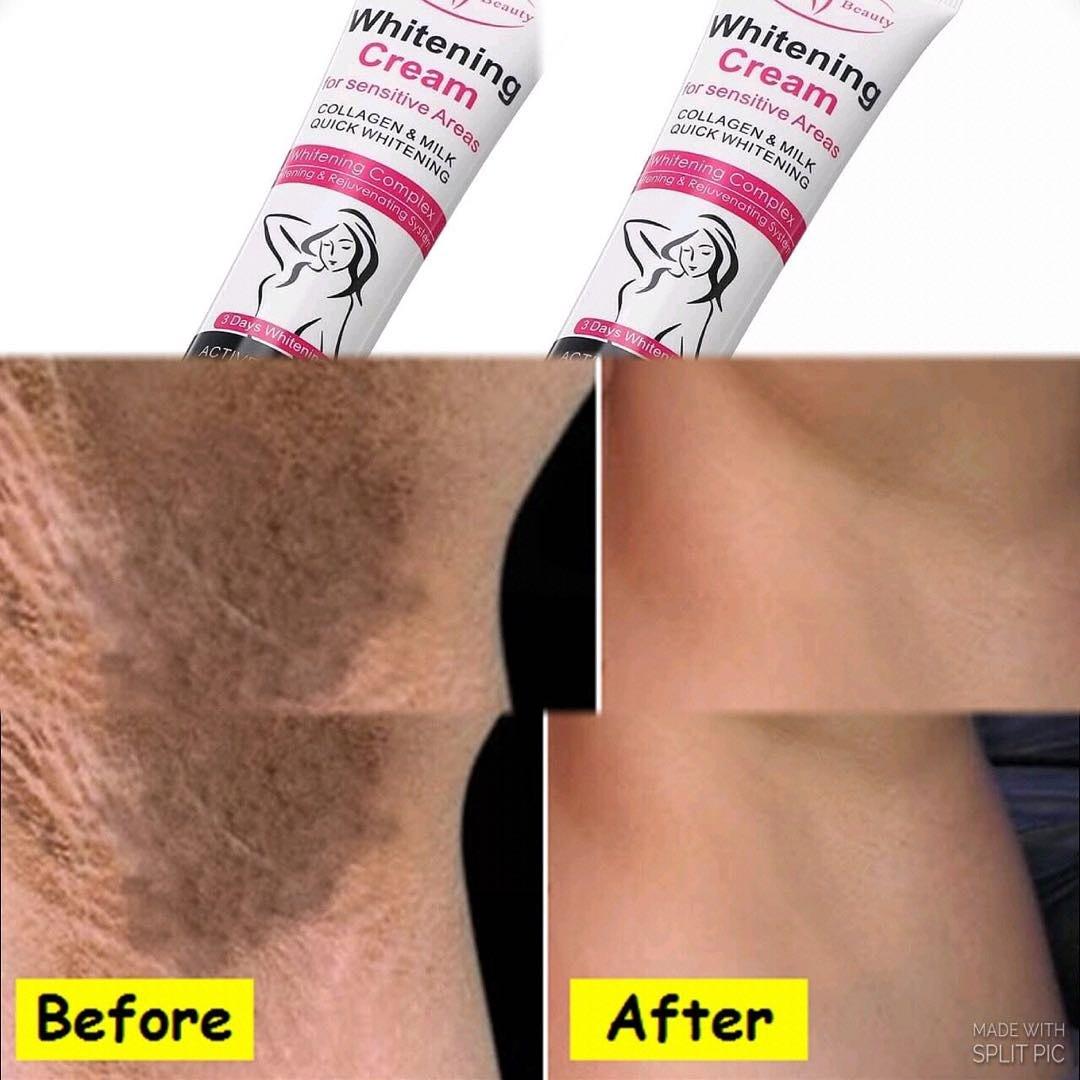 Krim Pemutih Ketiak Dan Bahagian Gelap Health Beauty Skin Bath Body On Carousell