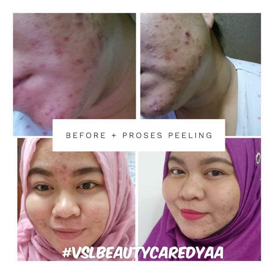 Vsl Beauty Care 3in1 Night Cream Health Beauty Skin Bath Body On Carousell