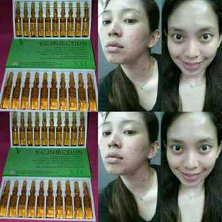 VC SERUM INJECTION ber EXP
