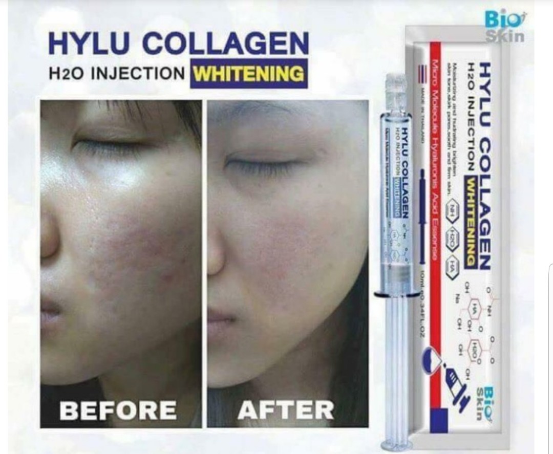 HYLU COLLAGEN H2O INJECTION WHITENING (BKK AUTHENTIC), Beauty ...