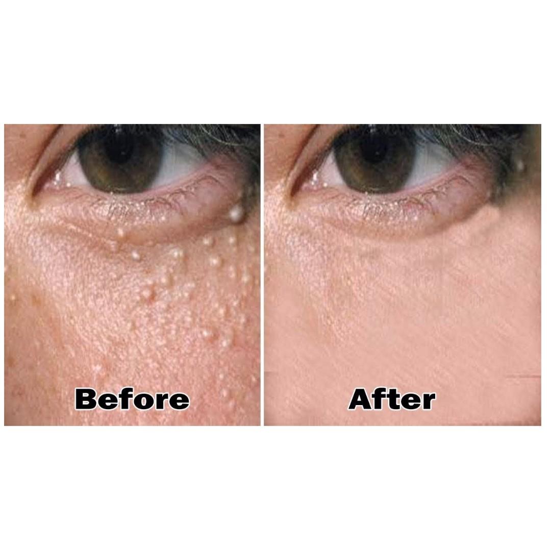 Oil online seed face