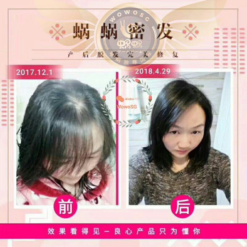 Wowo Ginger Shampoo Dry Oily Scalp Hair Loss Sensitive Scalp