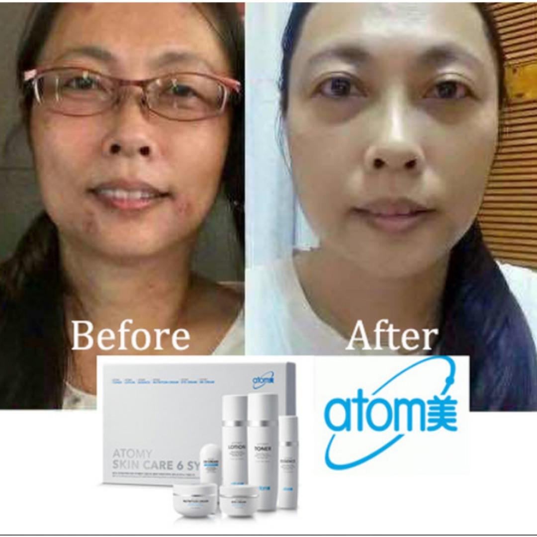 atomy skin care for combination skin