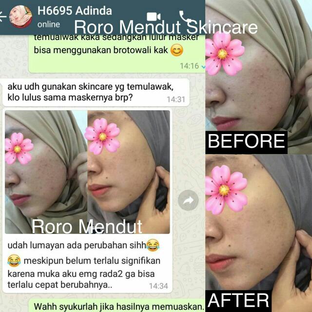 Atasi Jrawat Tanpa Takut Efek Samping Kesehatan Kecantikan Kulit Sabun Tubuh Di Carousell