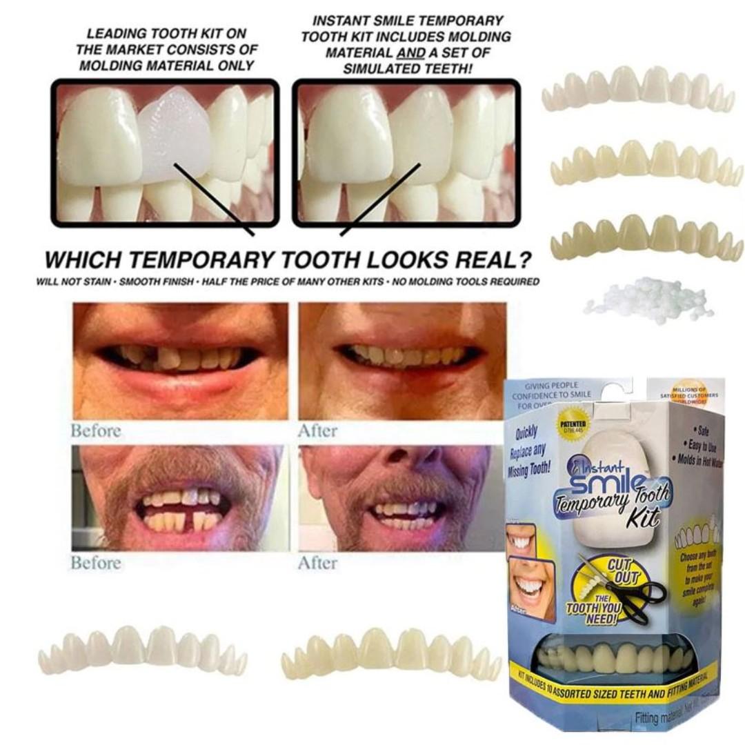 Instant smile temporary Tooth kit, Everything Else on Carousell