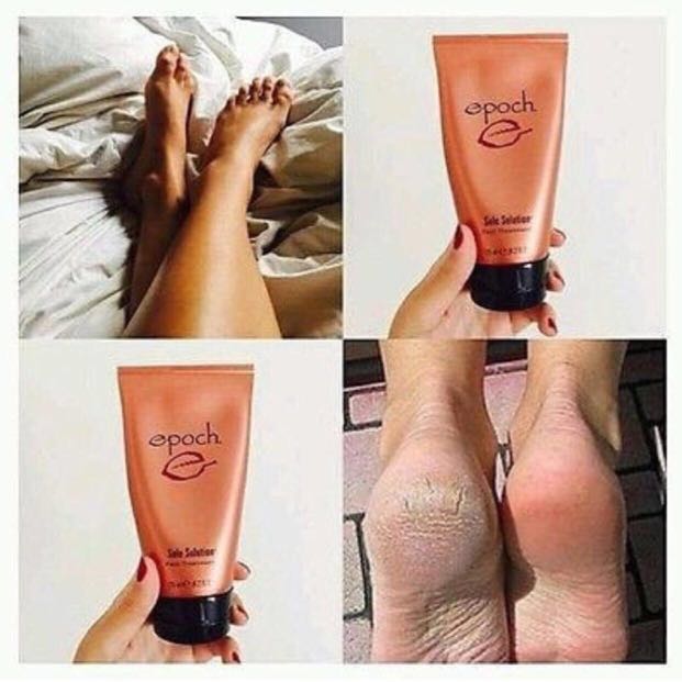 epoch sole solution foot treatment