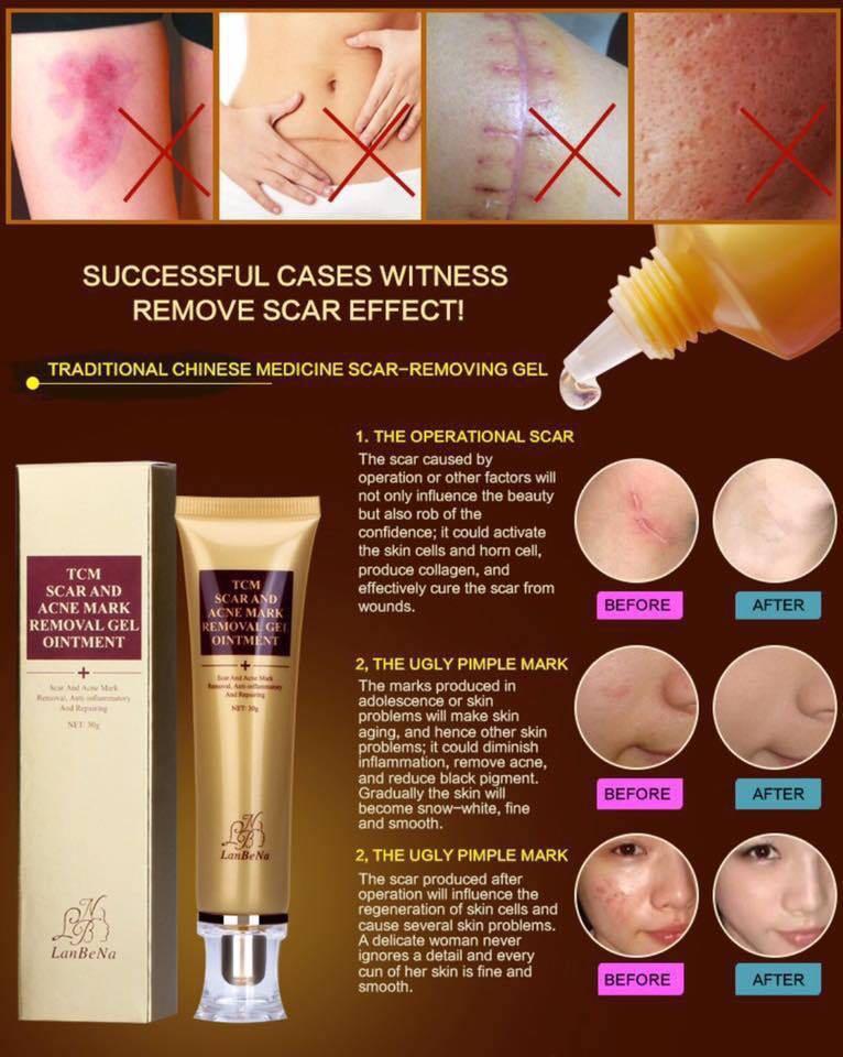 ORIGINAL LANBENA SCAR REMOVAL GEL, Beauty & Personal Care, Bath & Body