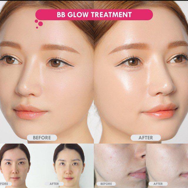 glow facial